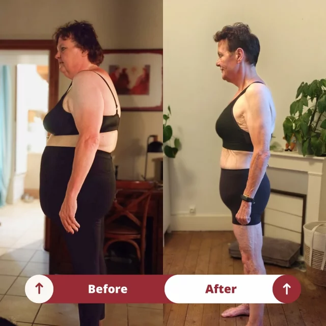 53 ans et 58kg de perdu ! 🤝🏻
Je ne vais pas m’attarder sur les méthodes qui ont été mises en place, je garde ça pour de futurs réels 
Je voudrais plutôt parler ici de force de caractère. Celle de Jitske, qui m’a bluffé durant tous ces mois de perte de poids et qui a réussi à motiver et inspirer bon nombre de personnes dans notre salle 🥇
Son histoire est assez incroyable. Énormément de réussite dans sa vie professionnelle. Plusieurs marathons terminés autour du monde qui ont forgé son mental de sportive. Puis, à sa 29e année, un drame qui l’a fait s’oublier et se réfugier dans la nourriture pendant plus de 20 ans.. 
C’est là qu’on démarre le suivi, à 128kg (départ 141kg avant de venir me voir). Les premiers mois sont compliqués, voir inexistant. Je décide donc d’avoir une conversation avec elle pour bousculer toutes les excuses qu’elle avait mis en place. Je l’oblige à m’envoyer son poids tous les matins avec une photo de sa balance
Résultats : gros déclic, pas un seul jour manqué et une perte de poids qui ne sait jamais arrêté jusqu’à aujourd’hui ! 
Une grande communication a été instaurée entre nous pour garder cette flamme intacte en elle 
Certains moments ont été plus durs que d’autres. Un décès, de la jalousie de la part de certains proches, des critiques pour rabaisser, des adhérents qui essayent de décourager, un camping à gérer etc… 
Tout autant de choses qui rendent la victoire encore plus belle et savoureuse ! 
Malgré cela, elle en a toujours fait plus que ce que je demandais. Un footing tous les matins, 6 cardios par semaine à la salle, 4 séances de muscu et une diète respectée même en vacances (elle avait 1h30 de route aller-retour pour venir 😉)
Rien que pour tout cela Jitske, je te dis un grand merci ! Merci pour ton investissement, ta confiance, ton courage et j’en passe. Tu es la cliente que les coachs rêvent d’avoir. Je suis extrêmement fier de toi. Ta seconde vie peut démarrer et j’ai hâte de te voir évoluer  vers de nouveaux objectifs (pro comme perso) ! 💎
ps : 6kg de peau ont été retiré durant l’abdominoplastie il y a une semaine, on peut dire qu’on est à -64kg nan ? 😂
#cut #transformationphysique #evolution #coaching #goal
