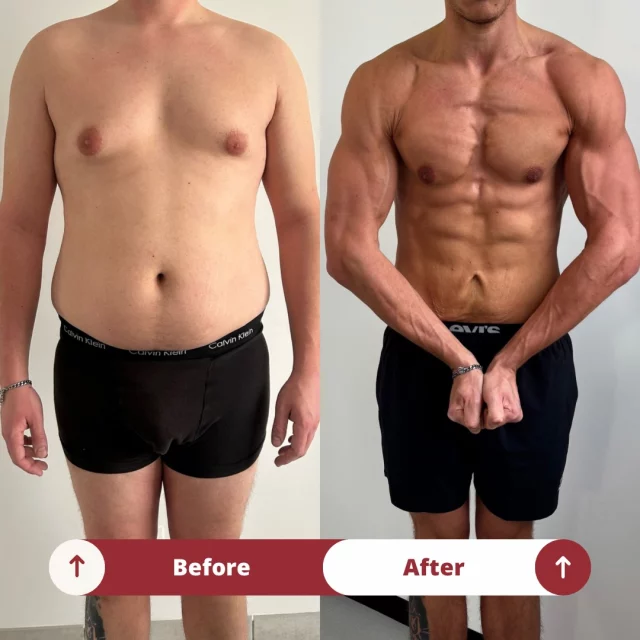 CUT : 103kg à 73kg 🤝🏻
Impossible de ne pas cacher ma fierté quand je vois le travail accompli par Lucas ! 
La première case a été coché ✅
Et pas des moindres.. -30kg pour cette première phase de perte de gras qui a été réalisé en deux fois. Deux blocs de cut avec une reverse au milieu. 
Au fur à mesure des grosses perte de poids j’ai remarqué que ce qui fait la différence entre ceux qui réussissent et les autres, c’est la mise en place d’une nouvelle routine. 
On ne prend pas autant de poids en ayant une bonne hygiène de vie. C’est la conséquence de plein de mauvaises habitudes qui s’accumulent chaque année..
Devoir revoir son alimentation, son activité physique journalière, les séances de muscu etc… et réussir à le tenir sur le moyen terme. Ce n’est pas pour tout le monde ! Vous devez en faire une priorité et le visualiser chaque semaine ! 🧠
Lucas ne s’est jamais posé de question. Diète suivi à la lettre, séance exécuté avec de l’intensité, aucun cardio de loupé (même plus que prévu). 
Maintenant place à la masse ! Les objectifs sont clairs 💎
Toi aussi TU peux changer et j’ai un plan bien précis pour ça ! Envoie moi un DM et je te l’explique en détail. 
#cut #transformationphysique #coaching #newlife #bodybuilding