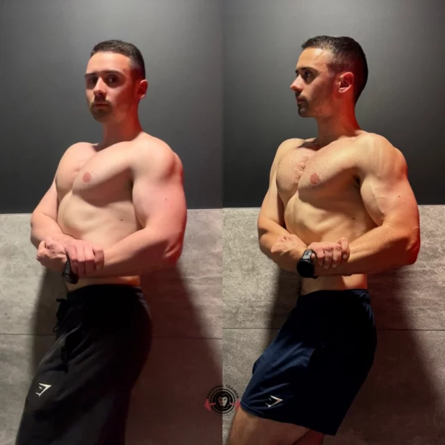 Update CUT ➡️ 16 semaines : -6kg 
On a opté pour une stratégie moins agressive que les sèches précédentes pour préserver un maximum de masse. 
Fin de masse : 3800kcal 600g de glucides au top de la masse. 
Descente progressive des calories en fonction des bilans et du visuel. 
Aujourd’hui : 
2250kcal 250g de glucides en ON 
1765kcal 150g de glucides en OFF 
Un jour haut par semaine à 400g de glucides. 
Cardio : 30’ 7/7 à partir de la 5e semaine de sèche à aujourd’hui. 
Ne restez pas bloqué sur votre poids lors d’un déficit calorique. Surtout lorsque vous avez un petit gabarit. 
Lorsque vous faites 60kg sec, vous n’avez pas la même capacité à perdre du poids aussi rapidement qu’un gars de 80kg. 
Soyez patient. 
Faites confiance au processus. 
À votre coach. 
Ensuite c’est Physique Prime. 
@cappe.coaching 💎
C’est pas terminé. Le meilleur est à venir ! 
« Quoique nous ayons accompli, nous ne pouvons nous contenter de ce que nous avons déjà fait. »
#bodybuilding #cut #natty #mindset #stayhard
