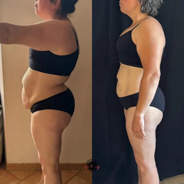 Coaching Lucie : -10kg en 20 semaines 🤝🏻
Sur ce type de profil, je ne cherche pas à être dans l’optimisation à 100%. 
L’objectif principal c’est d’avoir le plus d’adhérence possible au plan ! 
Contexte : 5 enfants, un travail très prenant, pas de sport depuis longtemps 
On est sur du coaching à distance donc on a mis 10k steps/jour, 2 séances de muscu à la maison et du cardio 3x/sem 
Le plan a été suivi à 80% et honnêtement, avec un environnement comme le sien, c’est déjà très bien ! 
On sait qu’on a de la marge de manœuvre pour accélérer le process et aller chercher encore 10kg 🎯
La première phase est terminée ! 
On s’y remet avec un peu plus d’optimisation dès ton retour de vacances Lucie 😈
- 
Infos et demandes de coaching en DM 📲
-
#win #transformationphysique #avantaprès #coach #lifestyle